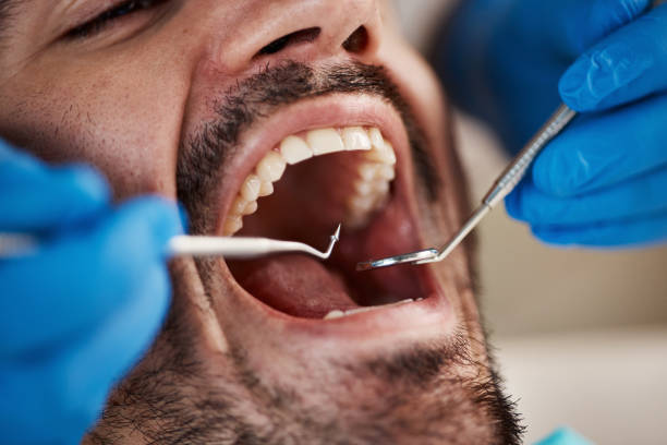 Fast & Reliable Emergency Dental Services in MO